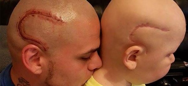 Συγκλονιστικός μπαμπάς έκανε τατουάζ το σημάδι του παιδιού του